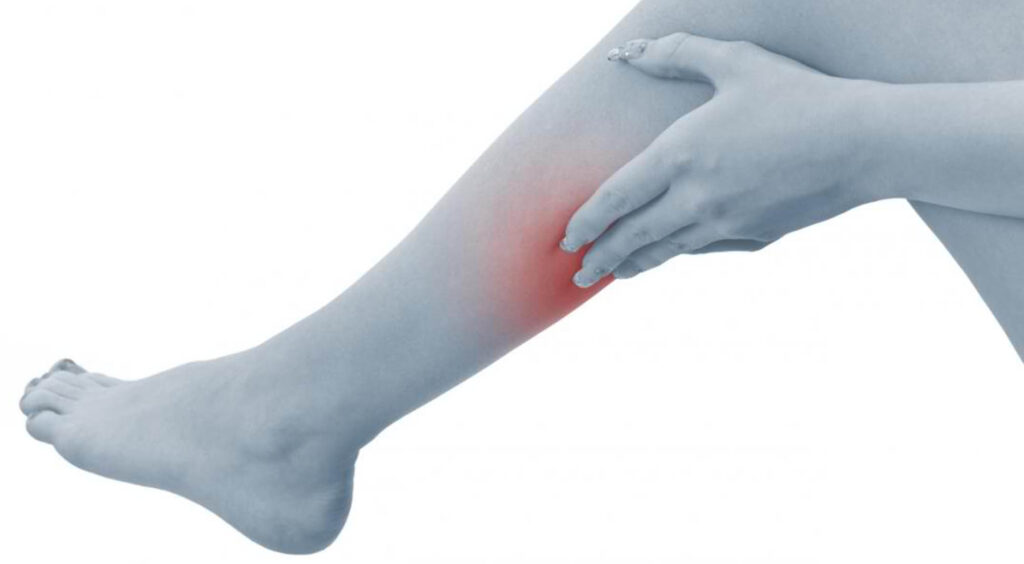 Sclerotheraphy for vein