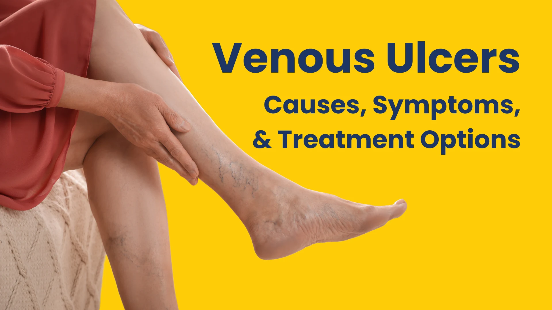 Venous ulcers