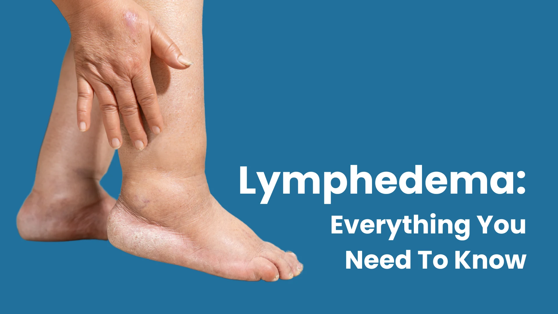 Lymphderma