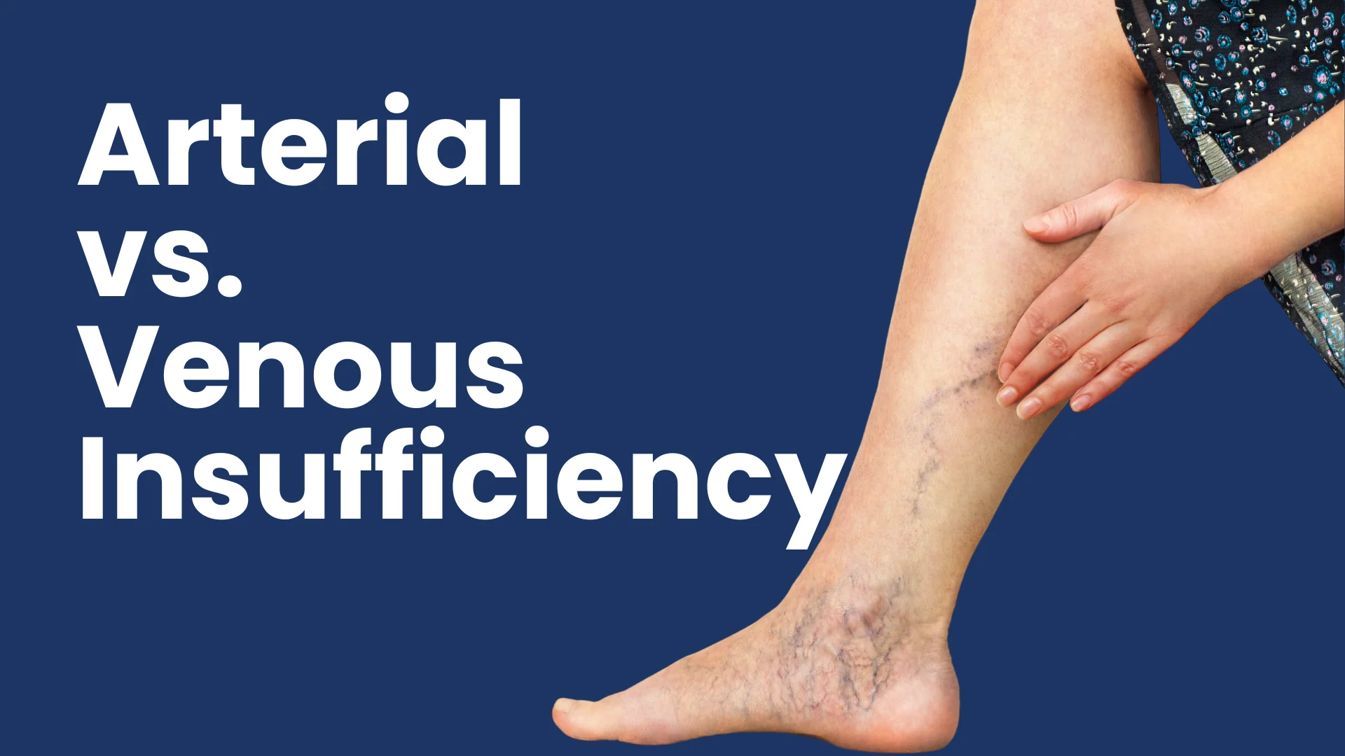 arterial vs venous