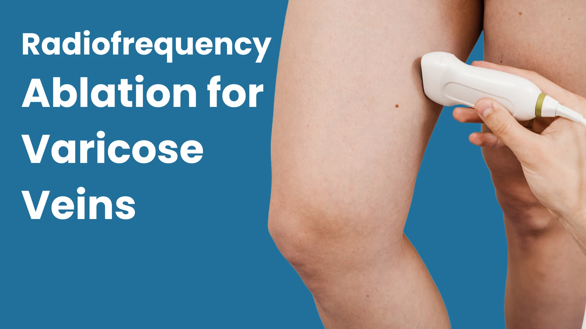 Radiofrequency