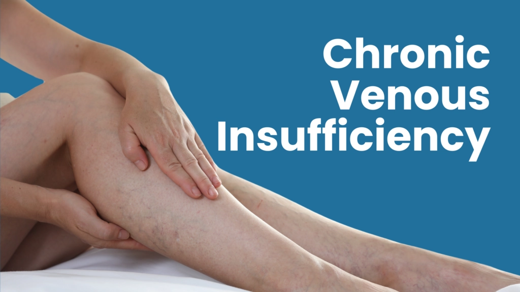 Chronic venous efficiency