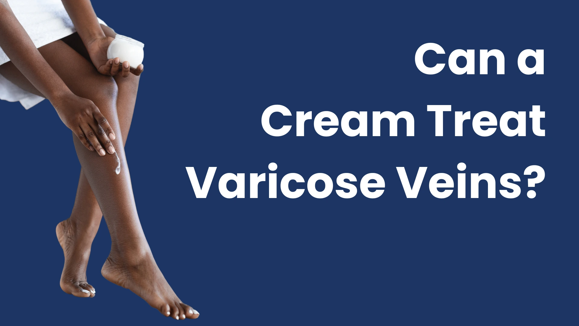 Varicose veins cream